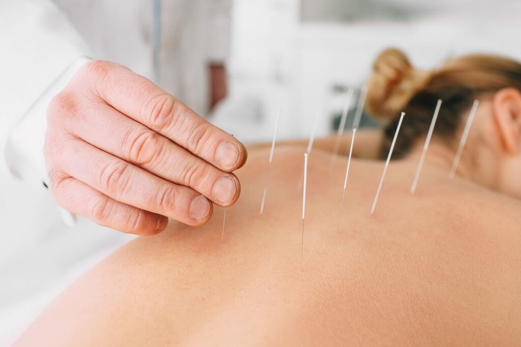 acupuntura e fadiga